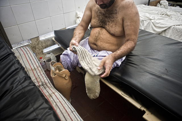 Víctor Álvarez perdió su pierna en la cárcel psiquiátrica después de que una leve herida se le infectara gravemente por estar su catre demasiado cerca del sanitario.
